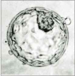 What is a Blastocyst?