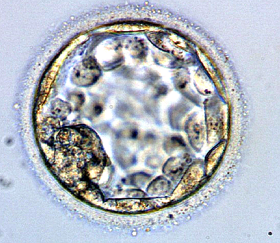 Gardner Embryo/Blastocyst Grading System