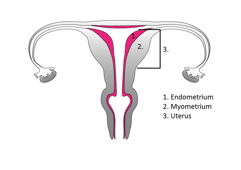 What is an Endometrial Receptivity Analysis Cycle (ERA)?